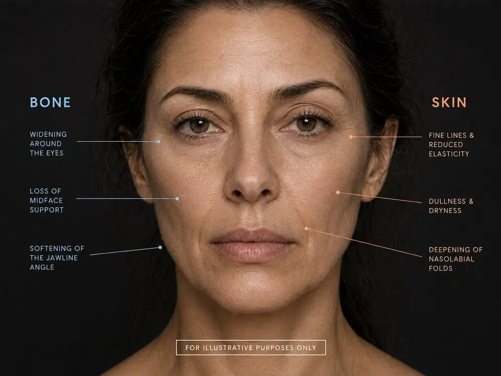 Diagram showing bone-related and skin-related signs of facial ageing